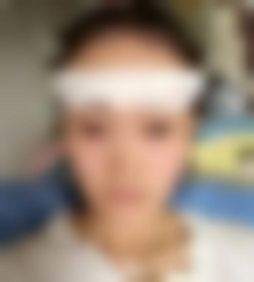 「昆明莱森植发」怎么样?正规吗|案例|价格表