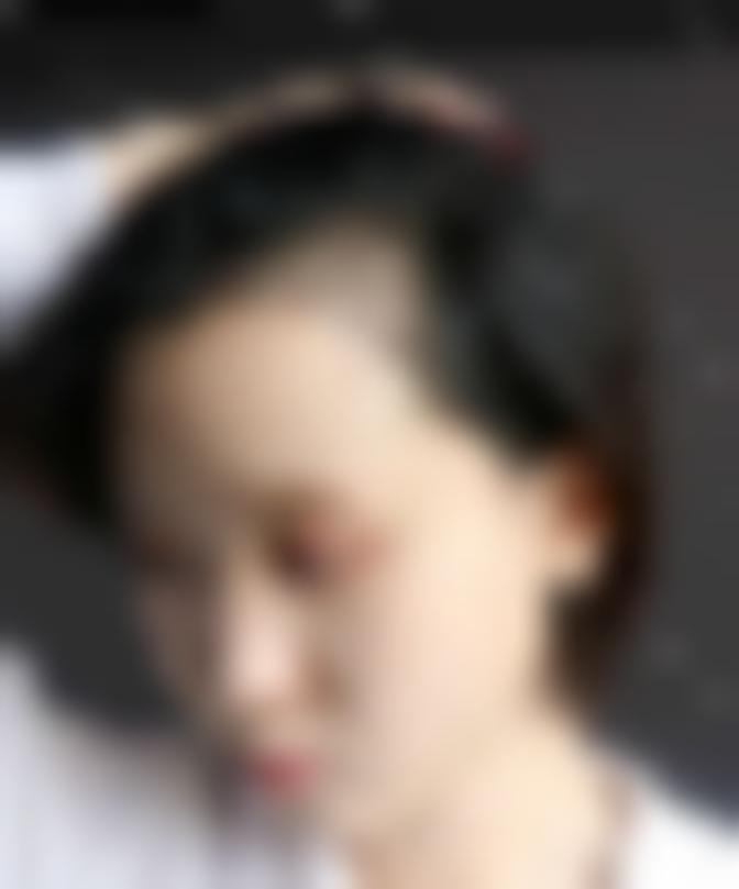 「贵阳碧莲盛植发」怎么样?正规吗|案例|价格表