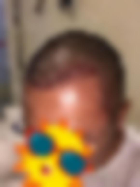 「大连瑞和医疗美容门诊部」怎么样?正规吗|案例|价格表