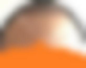 「青逸养发护理中心（罗湖店）」怎么样?正规吗|案例|价格表