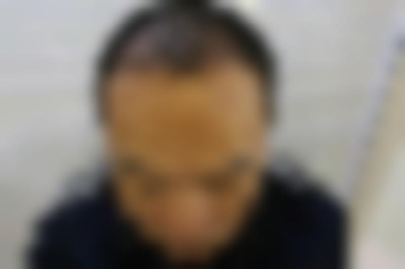 「玉林时光医疗美容门诊部」怎么样?正规吗|案例|价格表