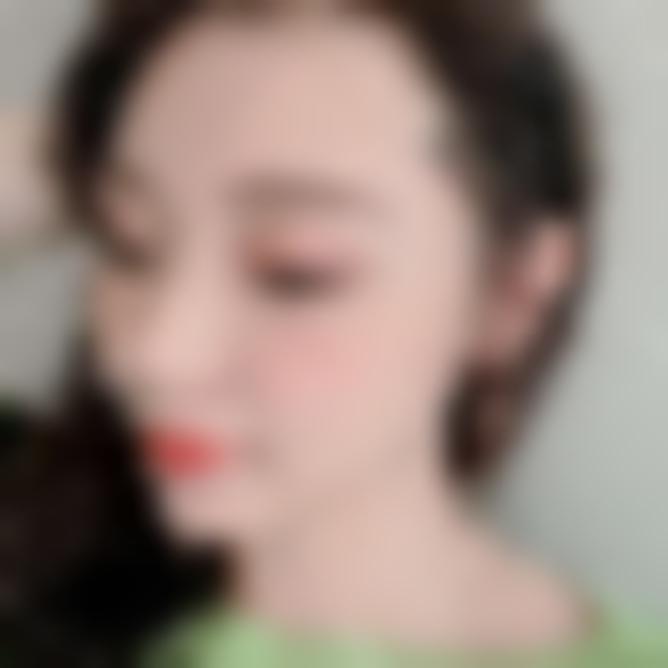 「成都欣奕医疗美容」怎么样?正规吗|案例|价格表