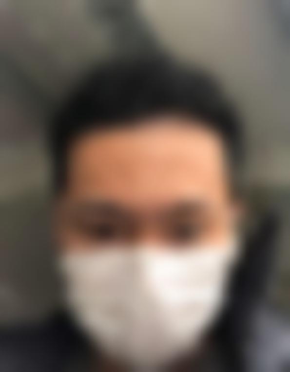 「北京煤炭总医院」怎么样?正规吗|案例|价格表