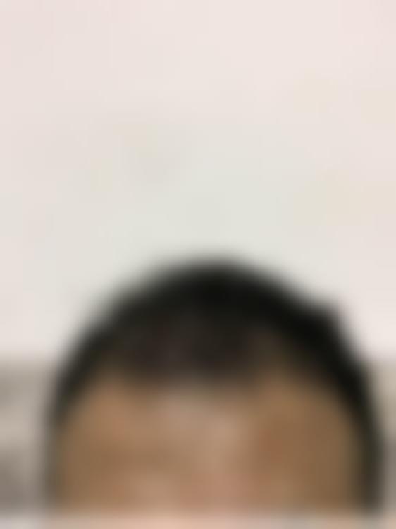 「安康青美医疗美容」怎么样?正规吗|案例|价格表