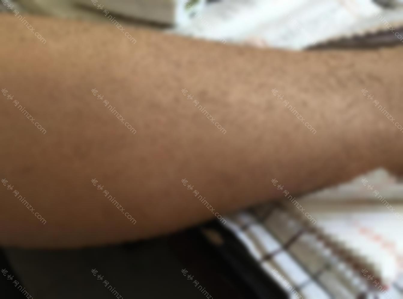 福州鼓楼医院脱毛怎么样？你对医院了解多少？