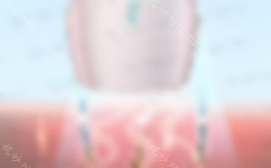 光子脱毛是永久性的吗？光子脱毛的操作原理是什么？需要准备什么吗？