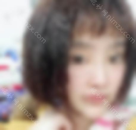 荆州中心医院整形技术怎么样？科室综合实力介绍 隆鼻病例