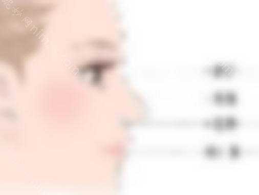 珠江医院齐向东做鼻子要多少钱？医生的技术可靠吗？假体隆鼻术后效果如何？！