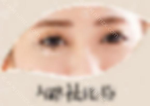 宜昌前卫整形赵云医生祛眼袋技术好吗？去除眼袋要多少钱？