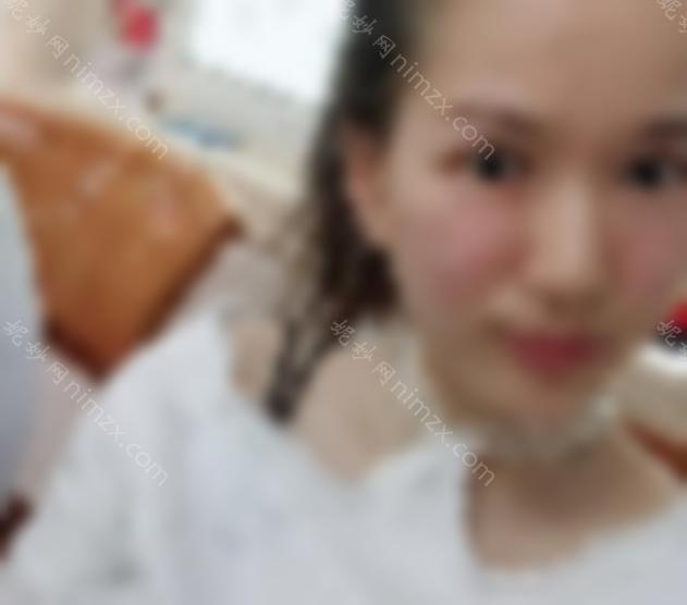 省中医院曾海峰祛眼袋怎么样？较新案例附上！