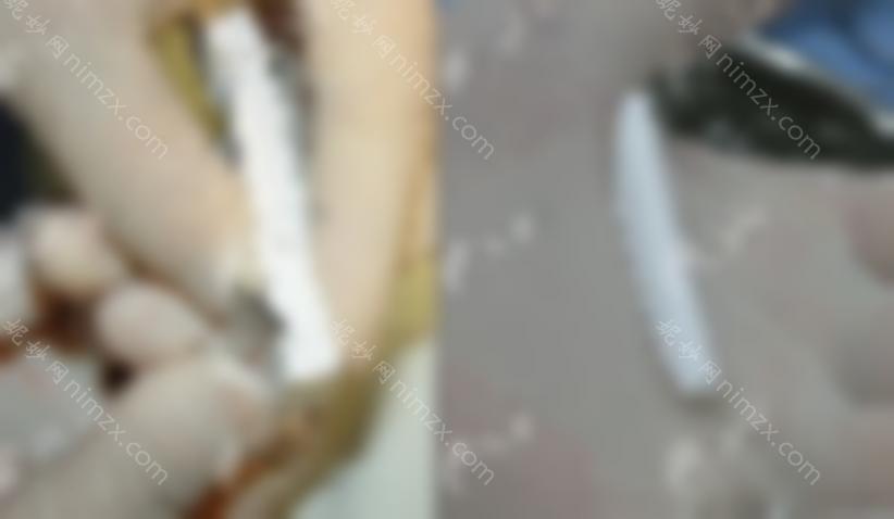 大连隆鼻医院排名前十，这些**医生做鼻子比较好