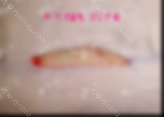 母亲的鼻子多少钱是由什么材料决定的，通常是耳软骨