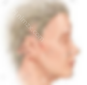 mini拉皮手术七天后变松怎么了？手术皮肤真的越来越松吗？