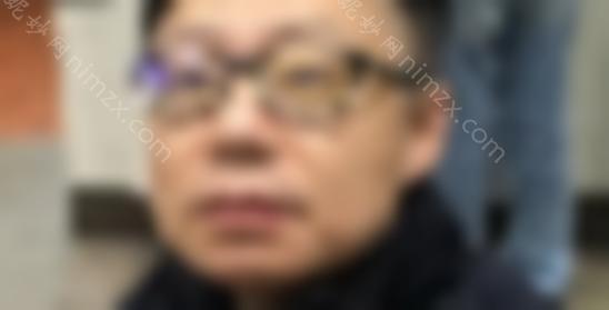 杭州浙江较好医院吸脂费清单！腹部抽脂术后1-30分享真实案例~