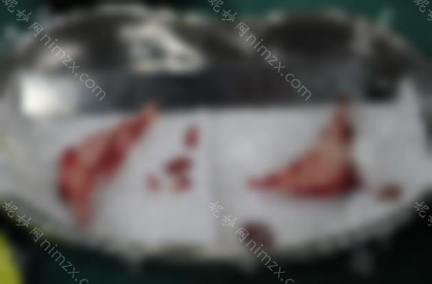 上海华美李志海和首尔丽格崔荣达比谁磨骨更好？