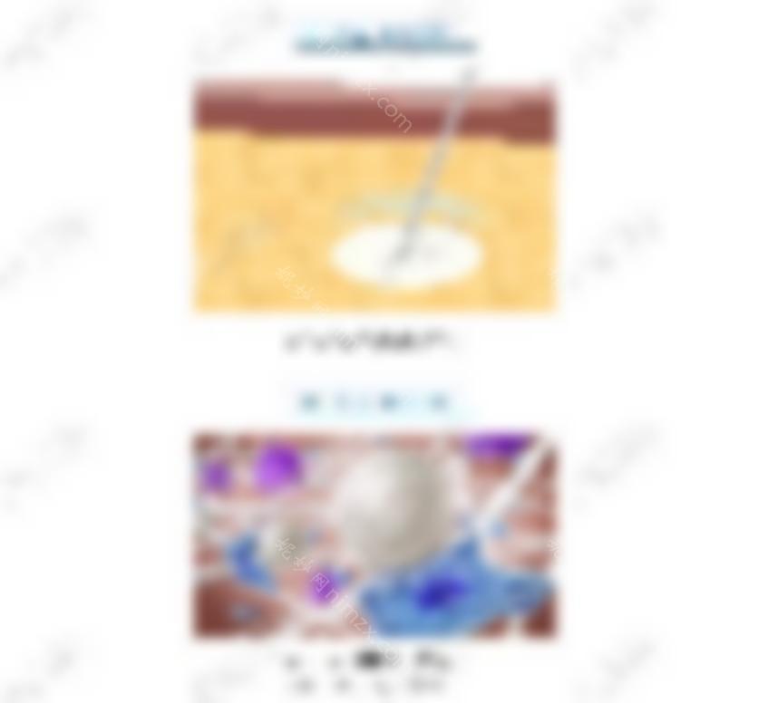 对比天使针和乔雅登丰颜透明质酸，看它填鼻子怎么样？