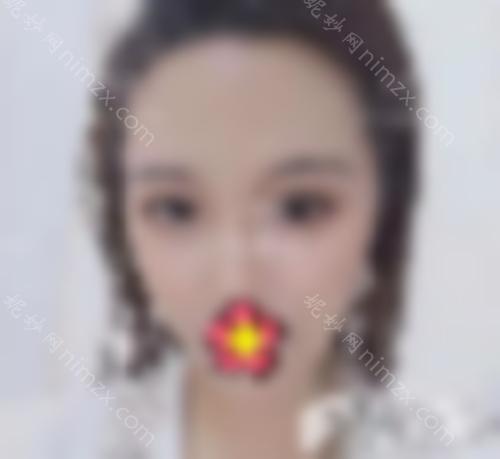 北京和美嘉和东方和谐哪个好？面部脂肪填充前我很纠结。！