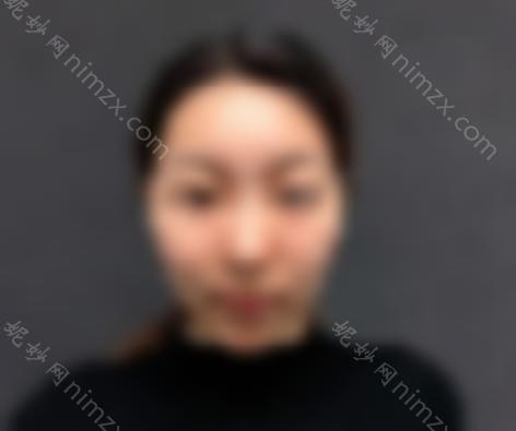 瘦脸*有什么效果？轻松注射一针会让你轻松告别大饼脸！如此轻松