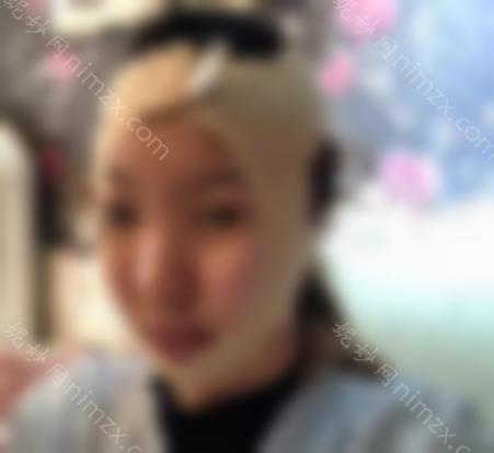瘦脸*有什么效果？轻松注射一针会让你轻松告别大饼脸！如此轻松