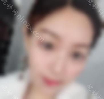 瘦脸*有什么效果？轻松注射一针会让你轻松告别大饼脸！如此轻松