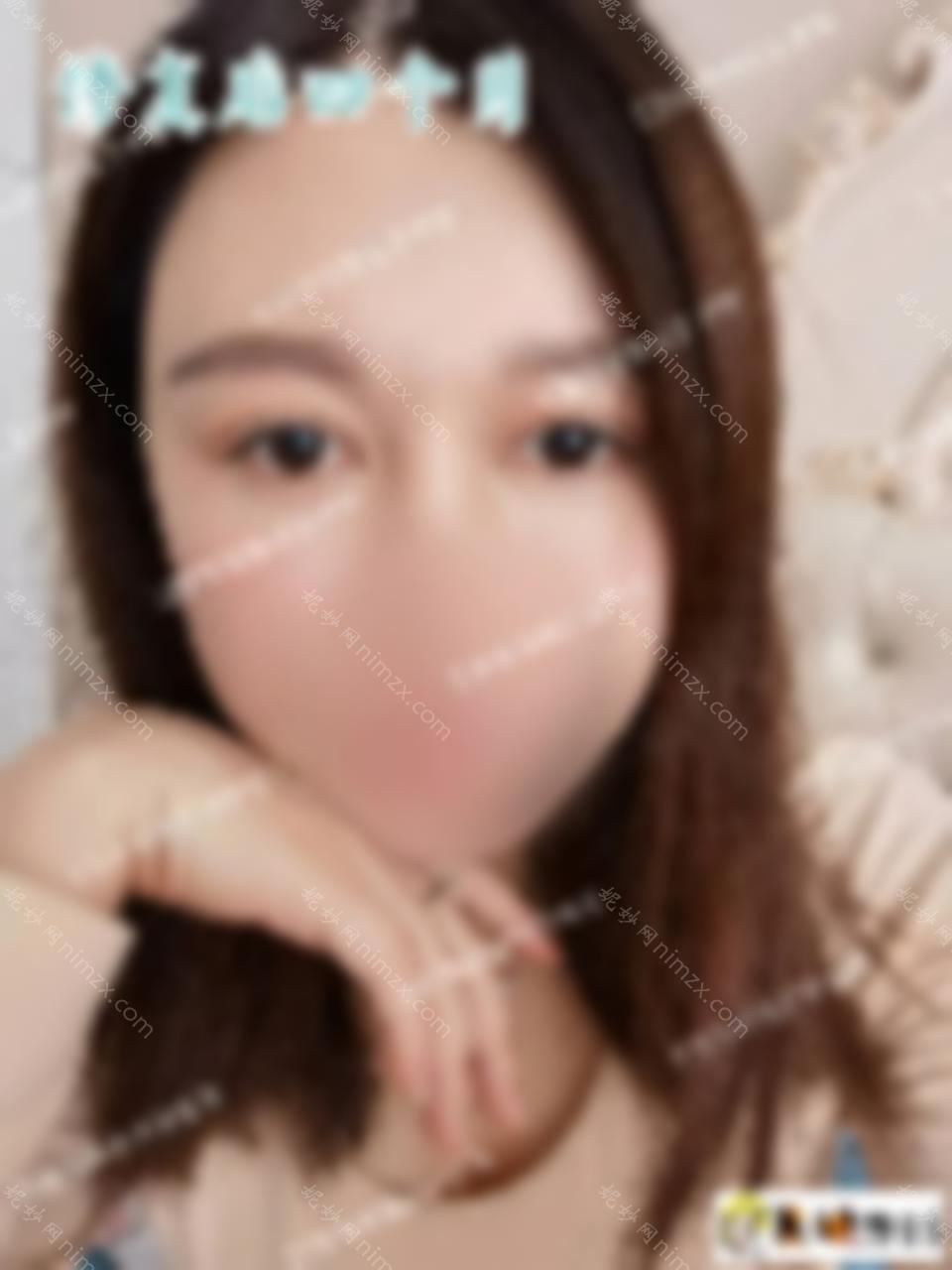 双眼皮修复手术使丑陋的双眼皮看起来理想！