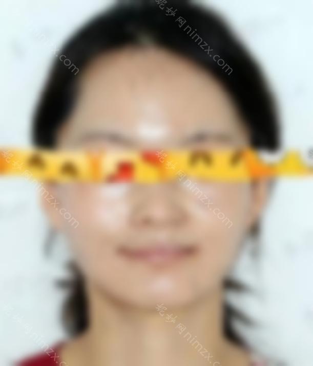 西南医院王振祥磨骨病例：医生综合实力分析 磨骨手术真实病例分享