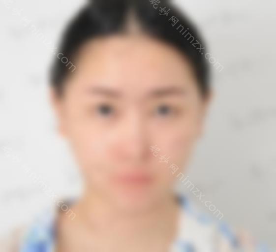 西安交通大学较好附属医院王瑞双眼皮修复价格表附双眼皮修复真实效果