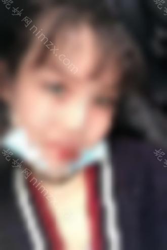 分享潘双眼皮修复案例~术后效果如何？双眼皮修复成功案例