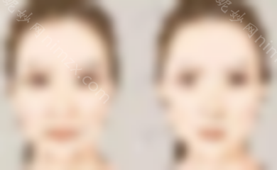 面部放松做速拉美真的能持续八年吗？pst哪个更适合面部提升？
