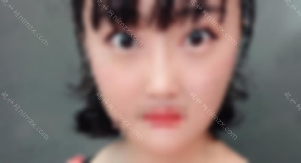张冰洁修好贵！但是效果真的很好！来看看我的双眼皮修复经验吧！