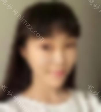 开眼角前后对比照片 向女神迈进了一步