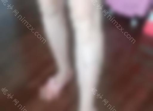 哈尔滨医科大学较好医院脱毛多少钱？医院开设哪些热门项目？