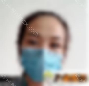 深圳周洪超开眼角塑形 双眼皮病例恢复|美丽日记