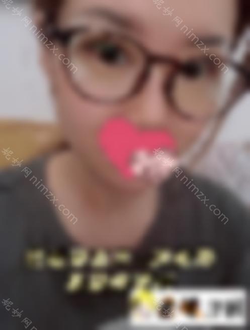 韩国开眼角整形手术效果如何？自然吗？韩国开眼角整形手术案例