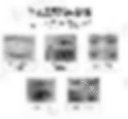 王海平的眼部修复手术怎么样？医生的技术好吗？双眼皮修复案例