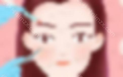曾经繁茂的双眼皮修复案例曝光！医生去医院|技术实力|双眼皮修复案例