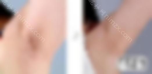 看脱毛前后的图片对比，就知道要不要做了。！