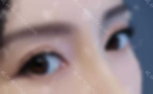 北京丰联丽格师丽丽双眼皮修复好吗？什么时候修好？
