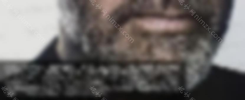 如何去除胡须？激光脱毛有什么注意事项吗？