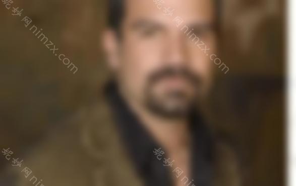 如何去除胡须？激光脱毛有什么注意事项吗？