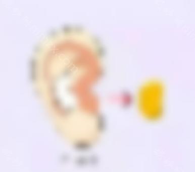 耳软骨垫鼻尖可靠吗？歪斜需要先修复吗？