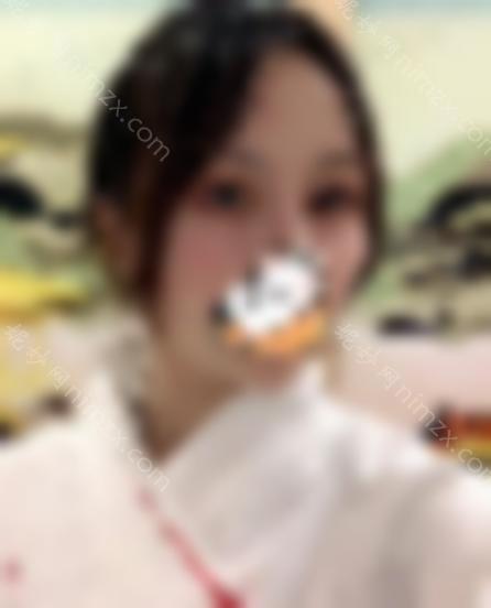 西京医院金长鑫双眼皮开眼角|内附医生介绍和手术案例