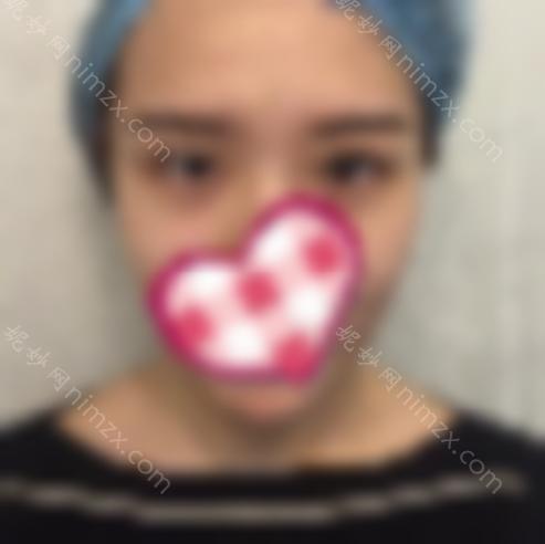 吴小蔚双眼皮修复案擅长项目 坐诊医院全新清单