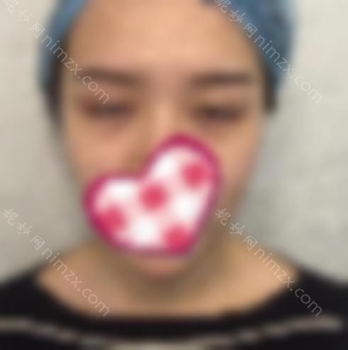 吴小蔚双眼皮修复案擅长项目 坐诊医院全新清单