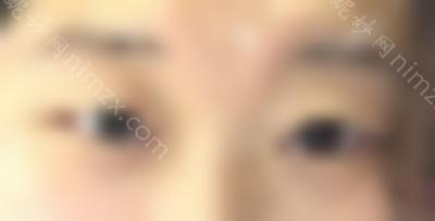 北京眼科综合医生名单曝光，排名单上双眼皮修复牛人