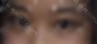北京眼科综合医生名单曝光，排名单上双眼皮修复牛人