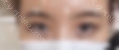 北京眼科综合医生名单曝光，排名单上双眼皮修复牛人
