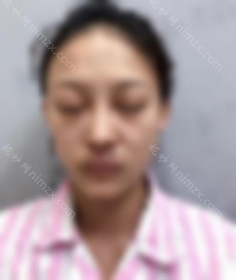 韩新鸣双眼皮修复多少钱？价格表 亲身体验双眼皮修复效果反馈