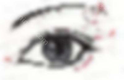朴相根院长的双眼皮修复怎么样？让我们来看看真实的案例分享，重生~