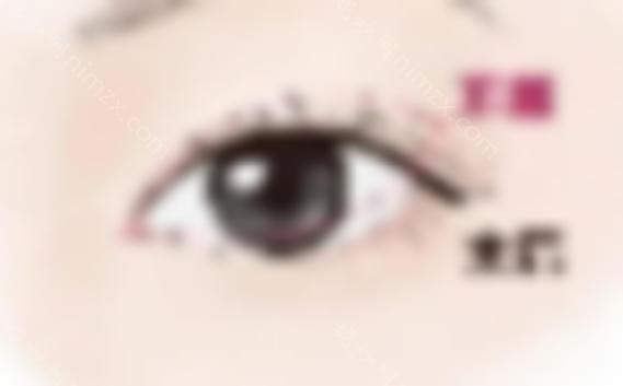 明星开眼角前后对比差距大吗？让眯着眼睛变大！